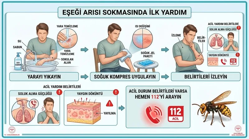 Eşek arısı sokması sonrası ilk yardım adımları — yıkama, soğuk kompres, acil belirtiler